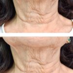 9 aliments à éviter… ou à préparer avec précaution